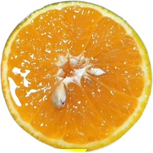 夏橙新鲜橙子10斤包邮秭归脐橙孕妇水果皮薄多汁榨汁